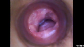 Endoscope camera shows pussy inside